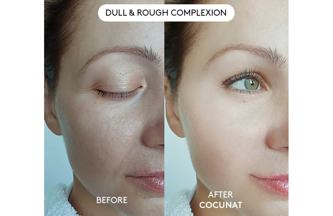 Clinical Beauty Filler With Free Serum 30ML