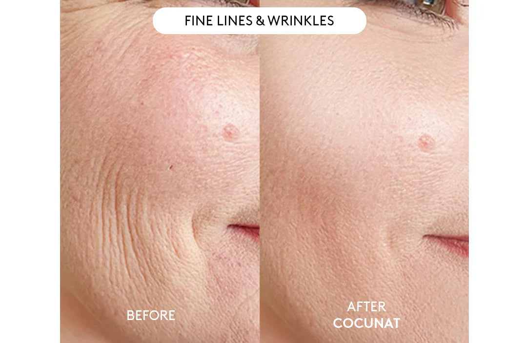 Clinical Beauty Filler With Free Serum 30ML