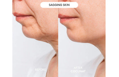 Clinical Beauty Filler With Free Serum 30ML