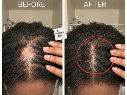 OrréNaturals™ Hair Revival Ampoule (1.5 fl. oz)